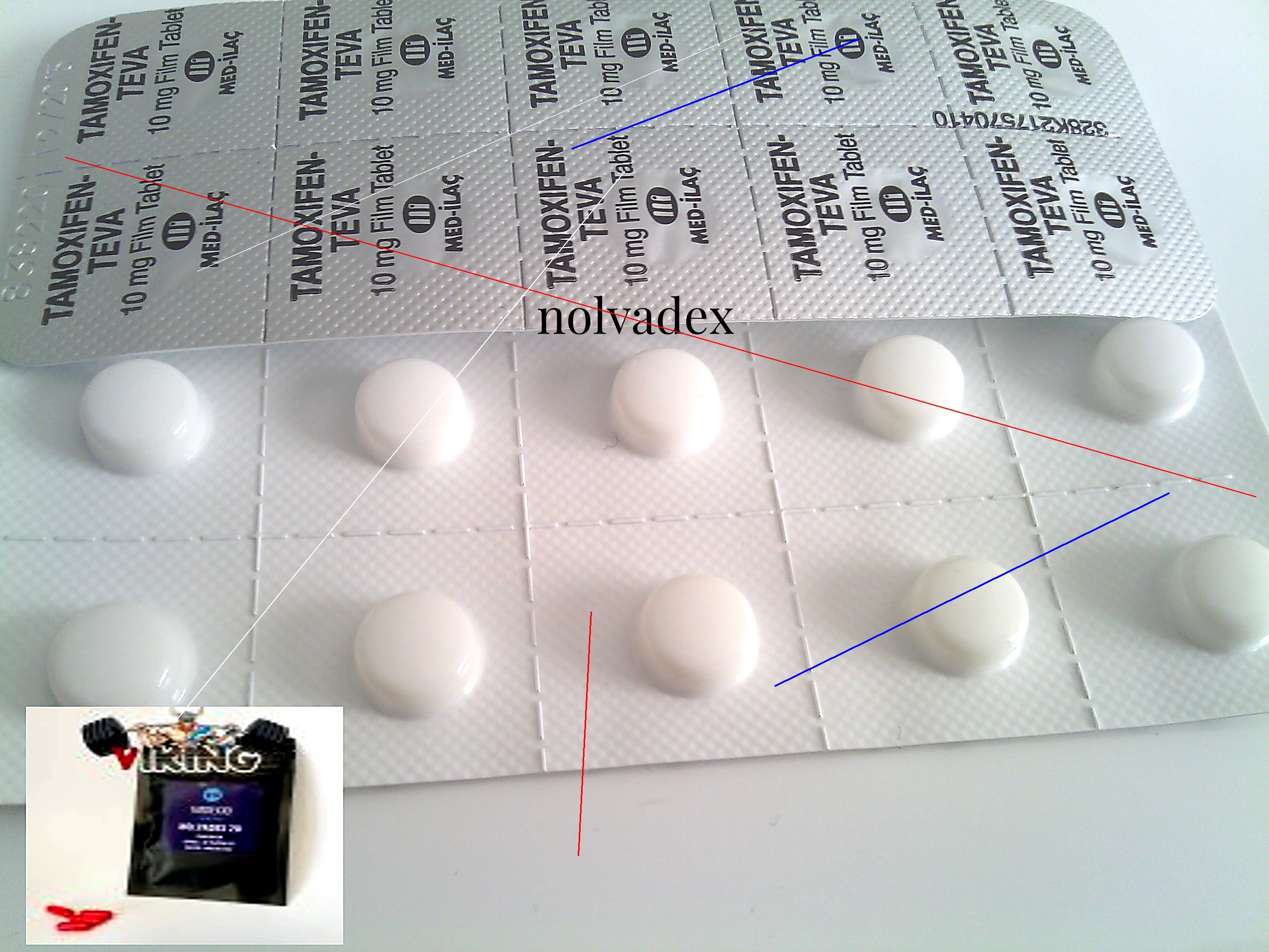 Prix nolvadex 20mg